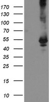 TDO2 Antibody - HEK293T cells were transfected with the pCMV6-ENTRY control (Left lane) or pCMV6-ENTRY TDO2 (Right lane) cDNA for 48 hrs and lysed. Equivalent amounts of cell lysates (5 ug per lane) were separated by SDS-PAGE and immunoblotted with anti-TDO2.