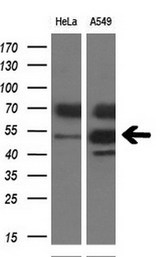 TDO2 Antibody - Western blot analysis of extracts (10ug) from 2 different cell lines by using anti-TDO2 monoclonal antibody at 1:200 dilution.