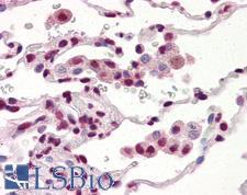 TDP-43 / TARDBP Antibody - Anti-TARDBP antibody IHC of human lung. Immunohistochemistry of formalin-fixed, paraffin-embedded tissue after heat-induced antigen retrieval. Antibody concentration 10 ug/ml.