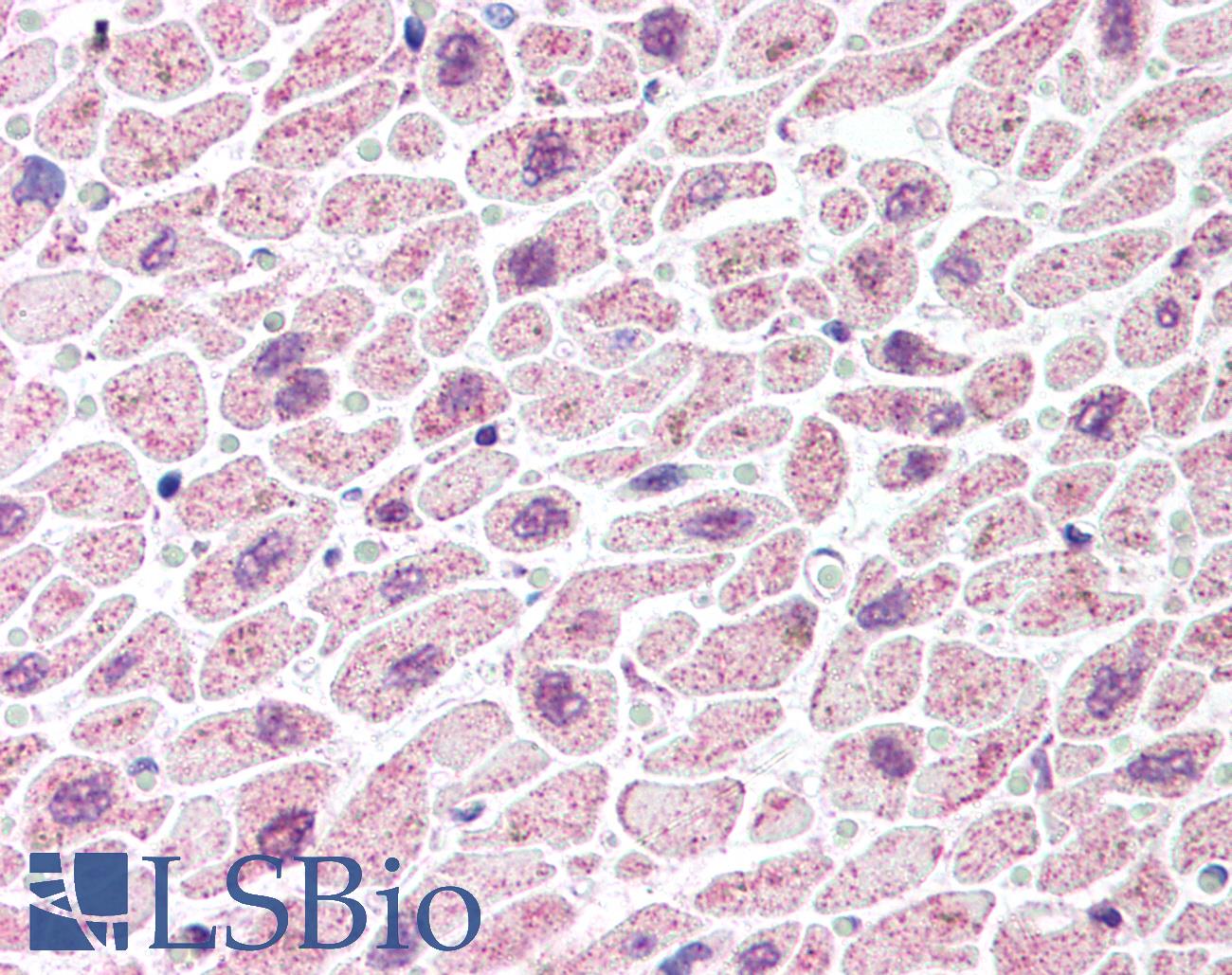 TDP-43 / TARDBP Antibody - Anti-TARDBP antibody IHC of human heart. Immunohistochemistry of formalin-fixed, paraffin-embedded tissue after heat-induced antigen retrieval. Antibody concentration 5 ug/ml.  This image was taken for the unconjugated form of this product. Other forms have not been tested.