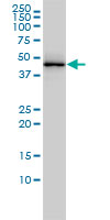 TDP-43 / TARDBP Antibody - TARDBP monoclonal antibody clone 2E2-D3 Western blot of TARDBP expression in A-431.