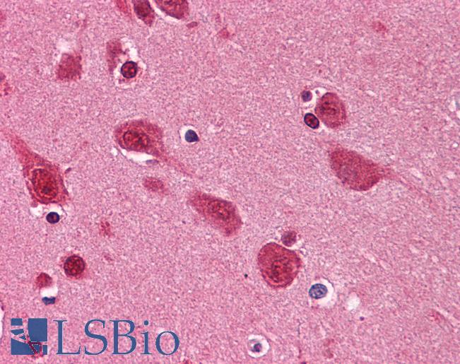 TDP-43 / TARDBP Antibody - Anti-TARDBP antibody IHC of human brain, cortex. Immunohistochemistry of formalin-fixed, paraffin-embedded tissue after heat-induced antigen retrieval. Antibody concentration 5 ug/ml.