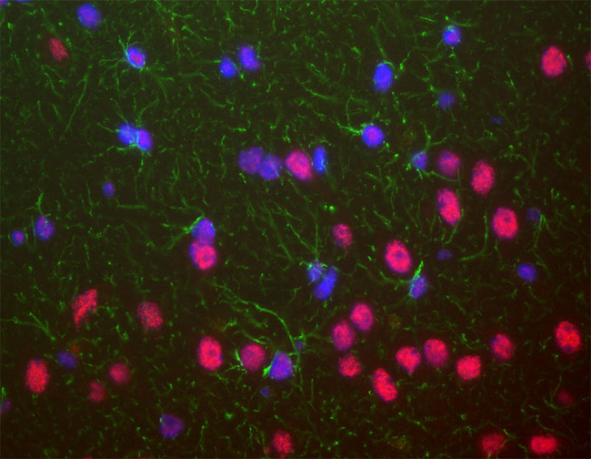 TDP-43 / TARDBP Antibody - TDP-43 / TARDBP antibody was used to stain a section of formalin fixed adult rat brain, specifically the hippocampus. Hippocampal neuron nuclei are stained strongly. Chicken antibody to GFAP CPCA-GFAP (green) shows the processes of astrocytic glial cells. Nuclei of all cells are revealed with DAPI DNA stain (blue). The TARDP antibody stains neuronal nuclei strongly and the nuclei of some non-neuronal cells much more weakly. Neuronal nuclei therefore look crimson, since they are both red due to the content of TDP43 and blue due to their content of DNA, stained blue with DAPI.