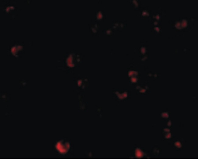 TDP-43 / TARDBP Antibody - Immunofluorescence of TDP43 in HeLa cells with TDP43 antibody at 20 ug/ml.