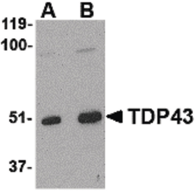 TDP-43 / TARDBP Antibody - Western blot of TDP43 in L1210 cell lysate with TDP43 antibody at (A) 0.5, (B) 1 and (C) 2 ug/ml.