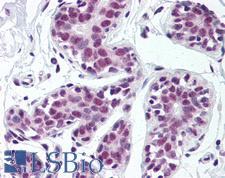 TDP-43 / TARDBP Antibody - Anti-TARDBP antibody IHC of human breast. Immunohistochemistry of formalin-fixed, paraffin-embedded tissue after heat-induced antigen retrieval. Antibody concentration 5 ug/ml.