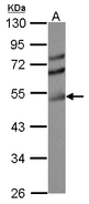 TDP2 / TTRAP Antibody - Sample (30 ug of whole cell lysate) A: HCT116 10% SDS PAGE TDP2 / TTRAP antibody diluted at 1:3000