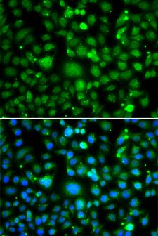 TEK / TIE2 Antibody - Immunofluorescence analysis of MCF7 cell using TEK antibody. Blue: DAPI for nuclear staining.