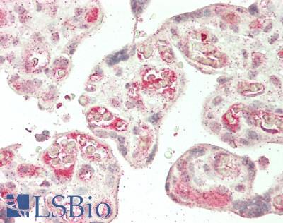 TEK / TIE2 Antibody - Human Placenta: Formalin-Fixed, Paraffin-Embedded (FFPE)