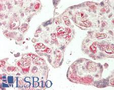 TEK / TIE2 Antibody - Human Placenta: Formalin-Fixed, Paraffin-Embedded (FFPE)