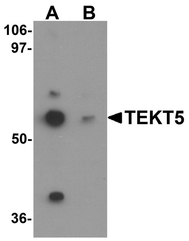 TEKT5 Antibody - Western blot analysis of TEKT5 in 3T3 cell lysate with TEKT5 antibody at (A) 0.25 and (B) 0.5 ug/ml.