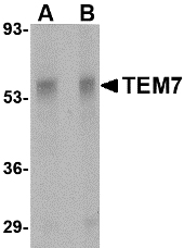 TEM7 Antibody - Western blot of TEM7 in rat liver tissue lysate with TEM7 antibody at (A) 0.5 and (B) 1 ug/ml.