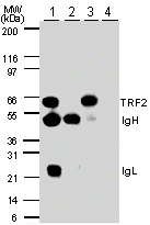 TERF2 / TRF2 Antibody - Immunoprecipitation (IP)/ Western blot of TRF2 in HL60 cells. Lane 1. IP with mouse anti-TRF2 antibody. Lane 2. IP with control mouse IgG. Lane 3 IP with goat anti-TRF2 antibody. Lane 4. IP with pre-immune goat Ig. TRF2 is detected as an ~66 kD protein.