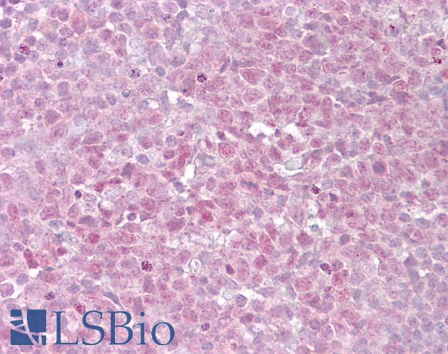 TERF2 / TRF2 Antibody - Anti-TERF2 antibody IHC of human tonsil. Immunohistochemistry of formalin-fixed, paraffin-embedded tissue after heat-induced antigen retrieval. Antibody concentration 15 ug/ml.