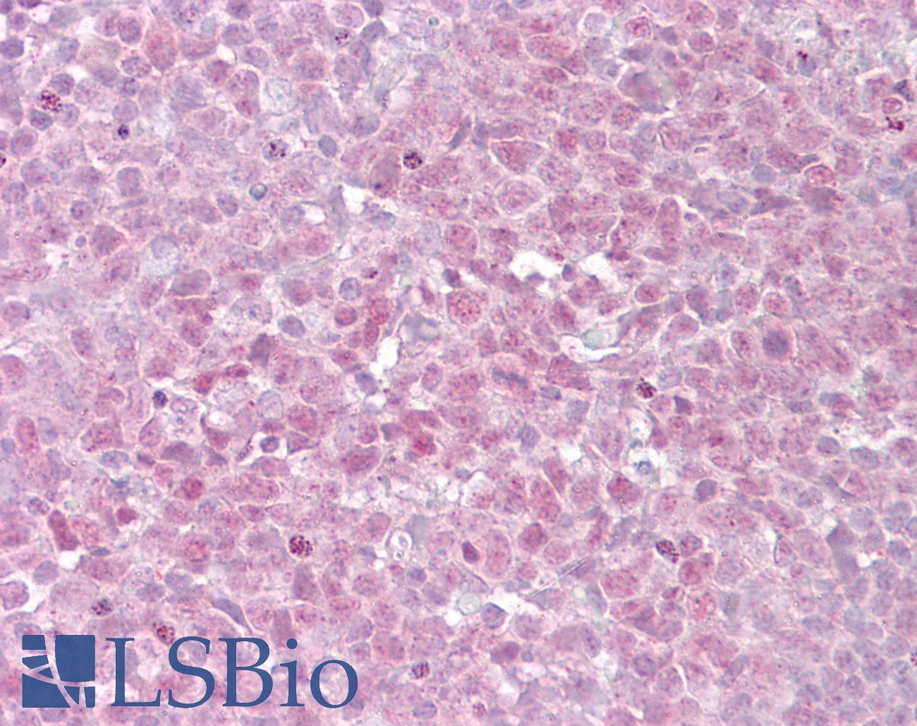 TERF2 / TRF2 Antibody - Anti-TERF2 antibody IHC of human tonsil. Immunohistochemistry of formalin-fixed, paraffin-embedded tissue after heat-induced antigen retrieval. Antibody concentration 15 ug/ml.