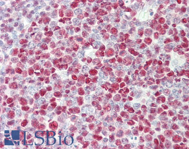 TERF2IP / RAP1 Antibody - Anti-TERF2IP / RAP1 antibody IHC staining of human tonsil. Immunohistochemistry of formalin-fixed, paraffin-embedded tissue after heat-induced antigen retrieval. Antibody concentration 5 ug/ml.