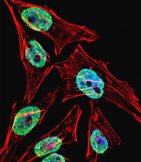 TERT / Telomerase Antibody - Fluorescent confocal image of HeLa cell stained with TERT Antibody. HeLa cells were fixed with 4% PFA (20 min), permeabilized with Triton X-100 (0.1%, 10 min), then incubated with TERT primary antibody (1:25, 1 h at 37°C). For secondary antibody, Alexa Fluor 488 conjugated donkey anti-rabbit antibody (green) was used (1:400, 50 min at 37°C). Cytoplasmic actin was counterstained with Alexa Fluor 555 (red) conjugated Phalloidin (7units/ml, 1 h at 37°C). Nuclei were counterstained with DAPI (blue) (10 ug/ml, 10 min). TERT immunoreactivity is localized to Nucleus significantly and Cytoplasm weakly.
