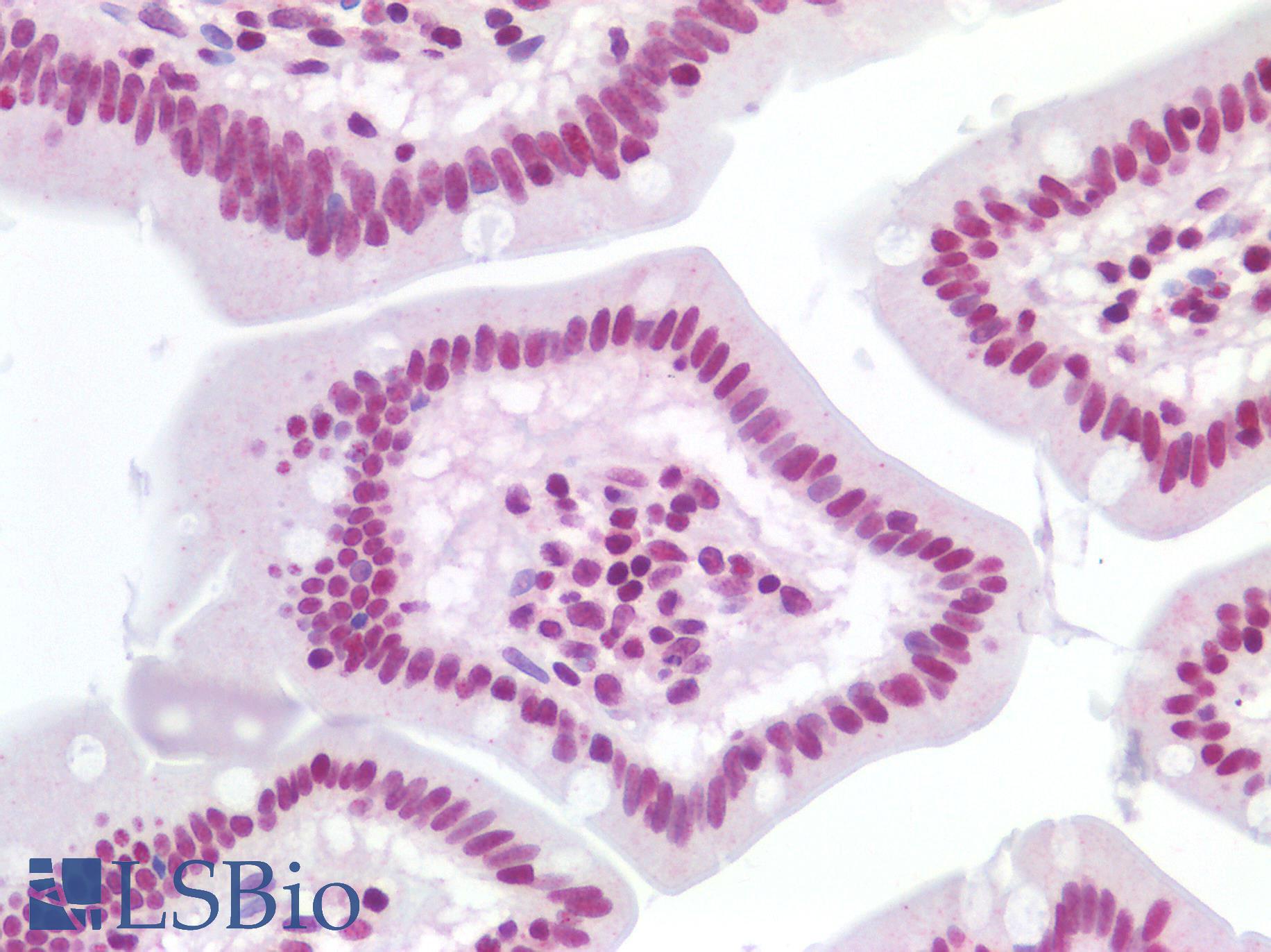 TERT / Telomerase Antibody - Human Small Intestine: Formalin-Fixed, Paraffin-Embedded (FFPE)