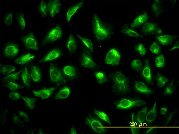 TES / Testin Antibody - Immunofluorescence of monoclonal antibody to TES on HeLa cell. [antibody concentration 10 ug/ml]