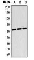 TESK2 Antibody - Western blot analysis of TESK2 expression in Raji (A); HepG2 (B); NIH3T3 (C) whole cell lysates.