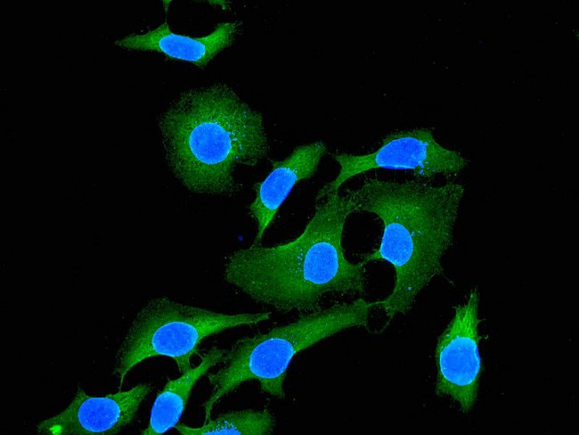 Testilin / EHD1 Antibody - Immunofluorescent staining of HeLa cells using anti-EHD1 antibody.