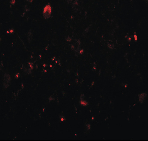 TET3 Antibody - Immunofluorescence of TET3 in human brain tissue with TET3 antibody at 20 ug/ml.