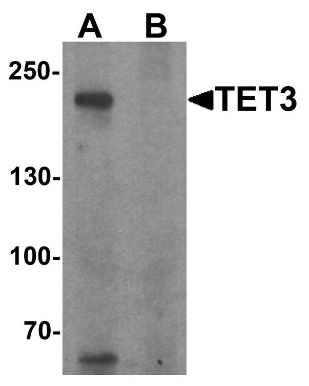 TET3 Antibody - Western blot analysis of TET3 in SK-N-SH cell lysate with TET3 antibody at 1 ug/ml in (A) the absence and (B) the presence of blocking peptide.