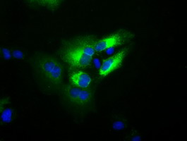 TF / Transferrin Antibody - Anti-TF mouse monoclonal antibody  immunofluorescent staining of COS7 cells transiently transfected by pCMV6-ENTRY TF.