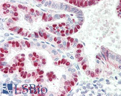 TFB1 / GTF2H1 Antibody - Human Uterus: Formalin-Fixed, Paraffin-Embedded (FFPE)
