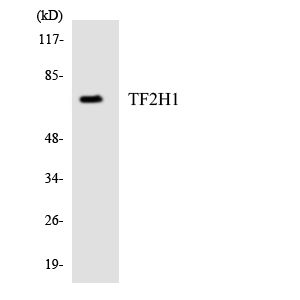 TFB1 / GTF2H1 Antibody - Western blot analysis of the lysates from HepG2 cells using TF2H1 antibody.