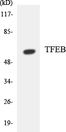 TFEB Antibody - Western blot analysis of the lysates from Jurkat cells using TFEB antibody.