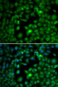 TFEB Antibody - Immunofluorescence analysis of MCF7 cell using TFEB antibody. Blue: DAPI for nuclear staining.