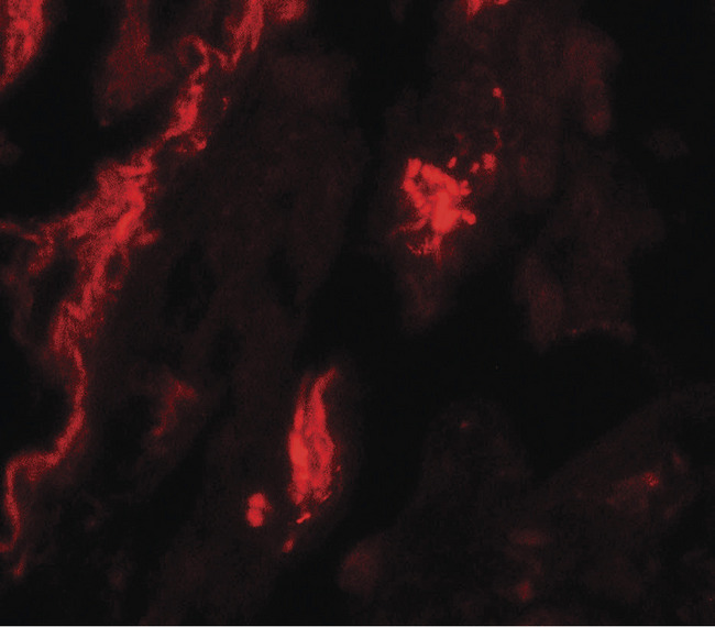 TFEB Antibody - Immunofluorescence of TFEB in human lung tissue with TFEB antibody at 20 ug/ml.