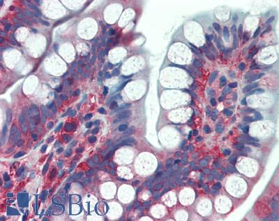 TFG Antibody - Human Small Intestine: Formalin-Fixed, Paraffin-Embedded (FFPE)