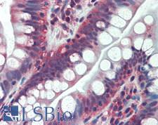 TFG Antibody - Human Small Intestine: Formalin-Fixed, Paraffin-Embedded (FFPE)
