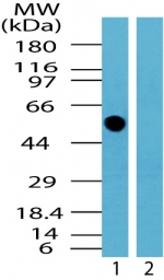 TFG Antibody - Western blot of human TFG protein in human brain lysate in the 1) absence and 2) presence of immunizing peptide using antibody at 0.5 ug/ml.