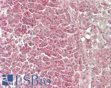 TFIP11 Antibody - Human Spleen: Formalin-Fixed, Paraffin-Embedded (FFPE)