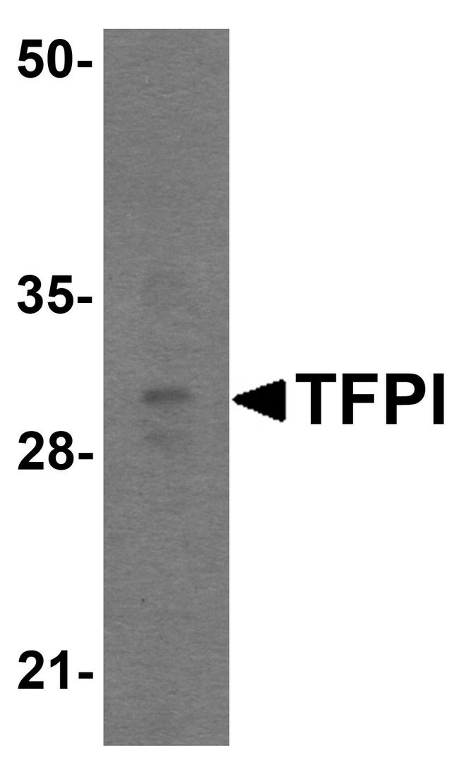 TFPI / LACI Antibody - Western blot analysis of TFPI in rat small intestine tissue lysate with TFPI antibody at 1 ug/ml.