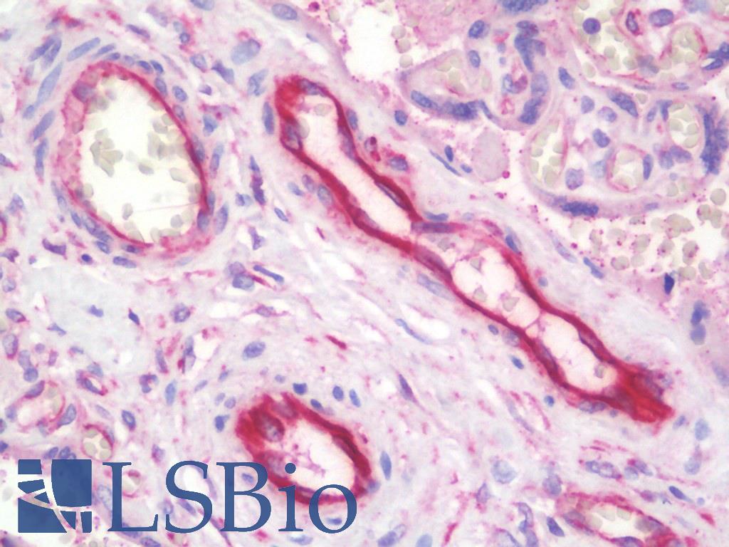 TFPI / LACI Antibody - Anti-TFPI / LACI antibody IHC staining of human placenta, endothelium. Immunohistochemistry of formalin-fixed, paraffin-embedded tissue after heat-induced antigen retrieval. Antibody concentration 10 ug/ml.