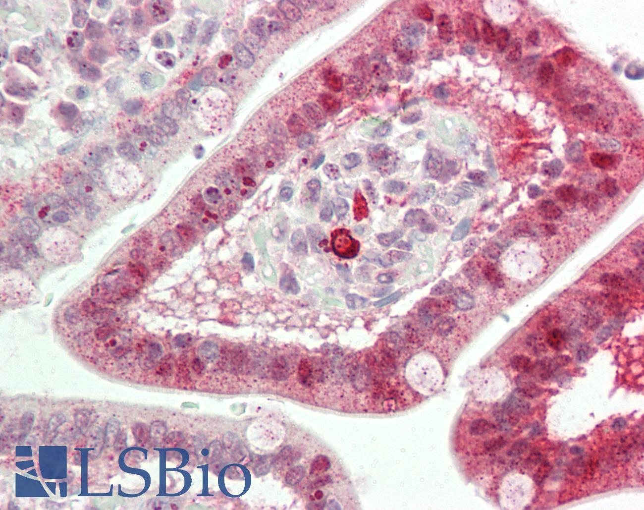 TFPI / LACI Antibody - Human Small Intestine: Formalin-Fixed, Paraffin-Embedded (FFPE)