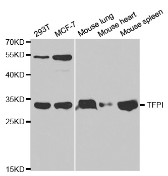 TFPI / LACI Antibody - Western blot analysis of extracts of various cell lines, using TFPI antibody at 1:1000 dilution. The secondary antibody used was an HRP Goat Anti-Rabbit IgG (H+L) at 1:10000 dilution. Lysates were loaded 25ug per lane and 3% nonfat dry milk in TBST was used for blocking.