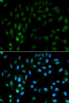 TFPI / LACI Antibody - Immunofluorescence analysis of MCF-7 cells using TFPI antibody. Blue: DAPI for nuclear staining.