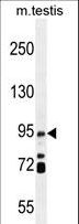 TG737 / IFT88 Antibody - IFT88 Antibody western blot of mouse testis tissue lysates (35 ug/lane). The IFT88 antibody detected the IFT88 protein (arrow).