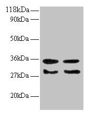 TGFA / TGF Alpha Antibody - Western blot All lanes: Protransforming growth factor alpha antibody at 2µg/ml Lane 1: EC109 whole cell lysate Lane 2: 293T whole cell lysate Secondary Goat polyclonal to rabbit IgG at 1/15000 dilution Predicted band size: 18, 17 kDa Observed band size: 30, 35 kDa