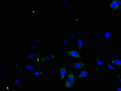 TGFA / TGF Alpha Antibody - Immunofluorescent analysis of Hela cells using TGFA Antibody at dilution of 1:100 and Alexa Fluor 488-congugated AffiniPure Goat Anti-Rabbit IgG(H+L)