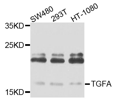 TGFA / TGF Alpha Antibody - Western blot analysis of extracts of various cell lines, using TGFA antibody at 1:1000 dilution. The secondary antibody used was an HRP Goat Anti-Rabbit IgG (H+L) at 1:10000 dilution. Lysates were loaded 25ug per lane and 3% nonfat dry milk in TBST was used for blocking. An ECL Kit was used for detection and the exposure time was 60s.