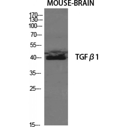 TGFB1 / TGF Beta 1 Antibody - Western blot of TGFbeta1 antibody