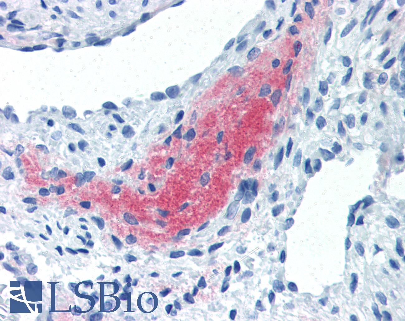 TGFB4 / LEFTY2 Antibody - Anti-LEFTY2 antibody IHC of human uterus, myometrium. Immunohistochemistry of formalin-fixed, paraffin-embedded tissue after heat-induced antigen retrieval. Antibody concentration 10 ug/ml.