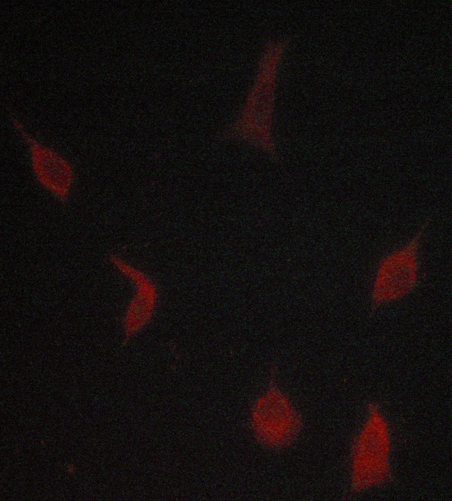 TGFBR1 / ALK5 Antibody - Staining LOVO cells by IF/ICC. The samples were fixed with PFA and permeabilized in 0.1% saponin prior to blocking in 10% serum for 45 min at 37°C. The primary antibody was diluted 1/400 and incubated with the sample for 1 hour at 37°C. A Alexa Fluor® 594 conjugated goat polyclonal to rabbit IgG (H+L), diluted 1/600 was used as secondary antibody.