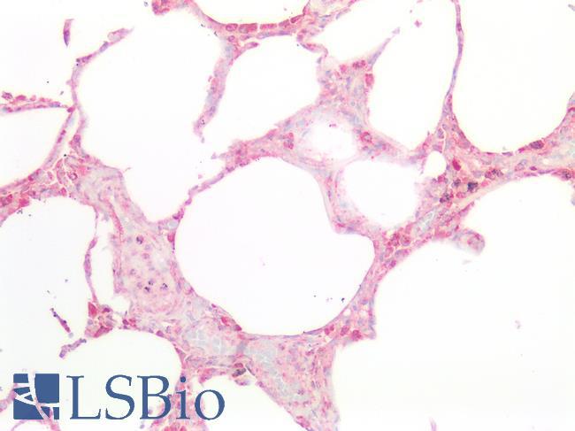 TGFBR1 / ALK5 Antibody - Human Lung: Formalin-Fixed, Paraffin-Embedded (FFPE)